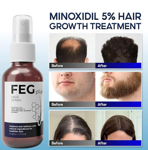 FEG PLUS Hair Growth Spray (Free Delivery)